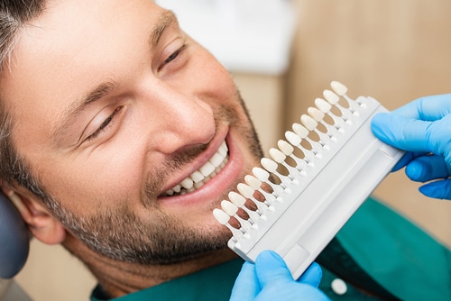 Procedura e processo delle faccette in porcellana Dentista di fama a Los Angeles
