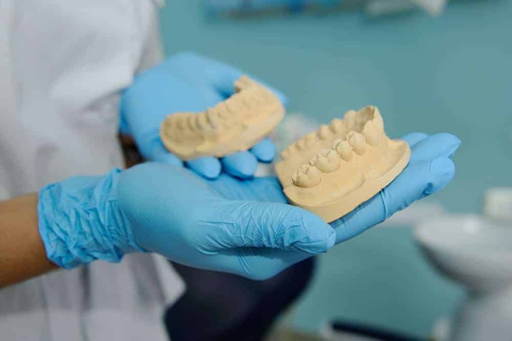 Durabilité des implants dentaires et des bridges dentaires