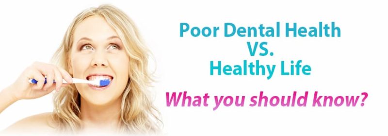 歯の健康-健康な人生-知っておくべきこと