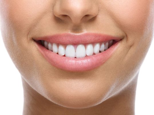 Teeth Whitening for Bonded Teeth