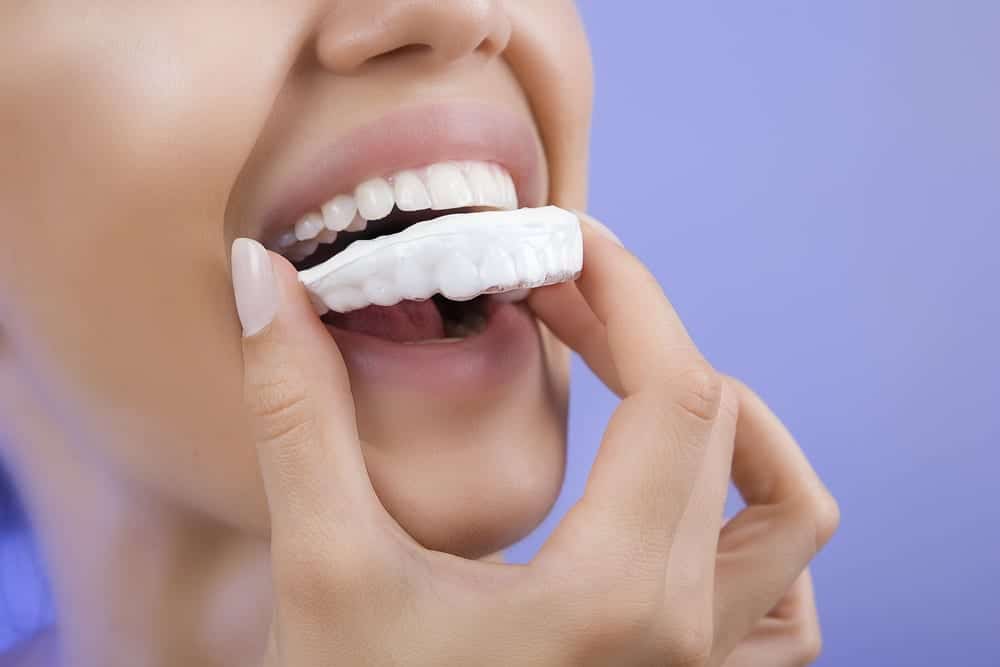 les-dangers-du-gel-de-blanchiment-des-dents