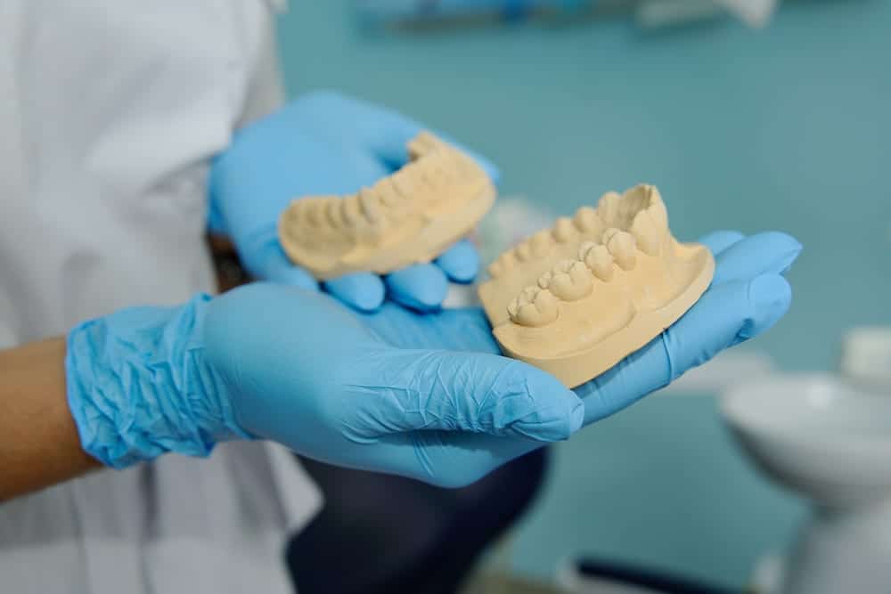 dental-implant