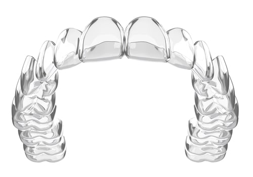 Ortodonzia istantanea con faccette di porcellana Dentista Invisalign