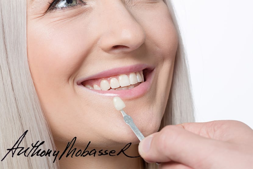 Best Veneer Dentist