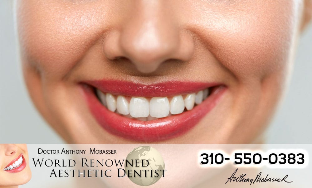 Best Cosmetic Dentist Beverly Hills