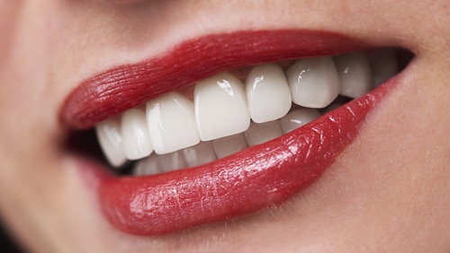 Dental Implants in Los Angeles Cosmetic Dentist Dr. Anthony Mobasser