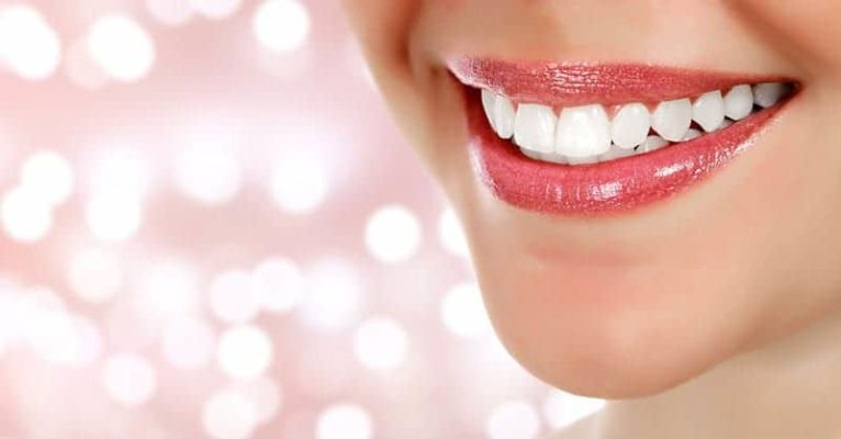 il miglior dentista per le faccette a Los Angeles