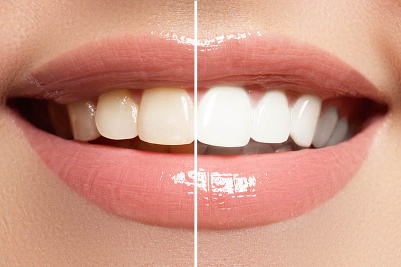 advancements made in esthetic dentistry in Los Angeles