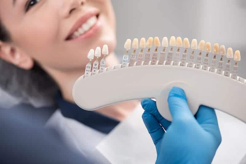 How Much Do Porcelain Veneers Cost In Los Angeles