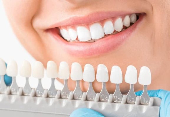 When You Need a Cosmetic Dentist in Los Angeles