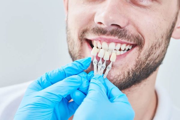 Complete Dental Reconstruction in Los Angeles