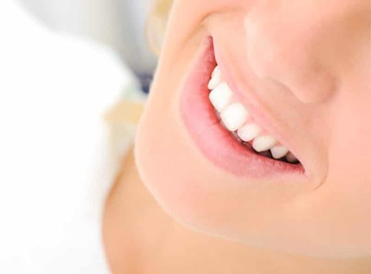 Cosas que debe saber antes de blanqueamiento dental Los Angeles dentistas