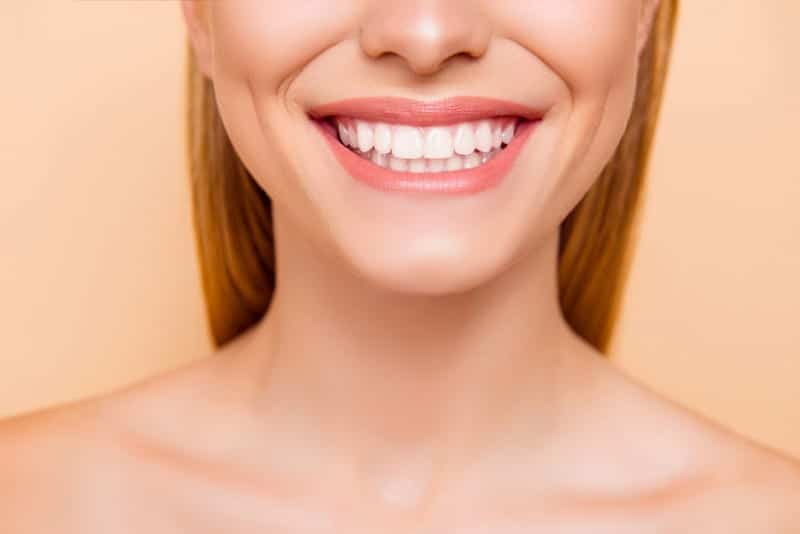 Things You Should Know Before Teeth Whitening Los Angeles dentists1