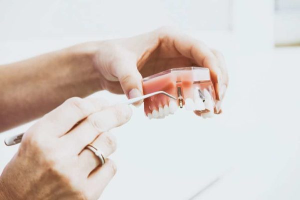 dentiste implants dentaires