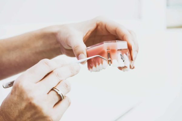 Dentiste spécialisé dans les implants à Los Angeles