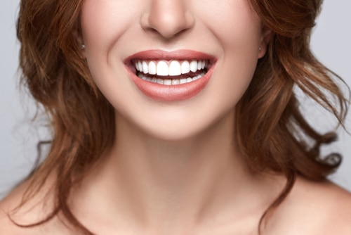 Teeth Whitening & Teeth Bleaching in Los Angeles  Dr. Anthony Mobasser