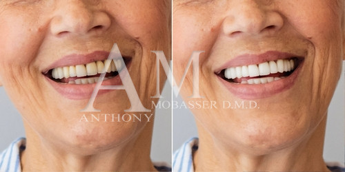 Photo Gallery | Dr. Anthony Mobasser | Best Celebrity Dentist in Los Angeles